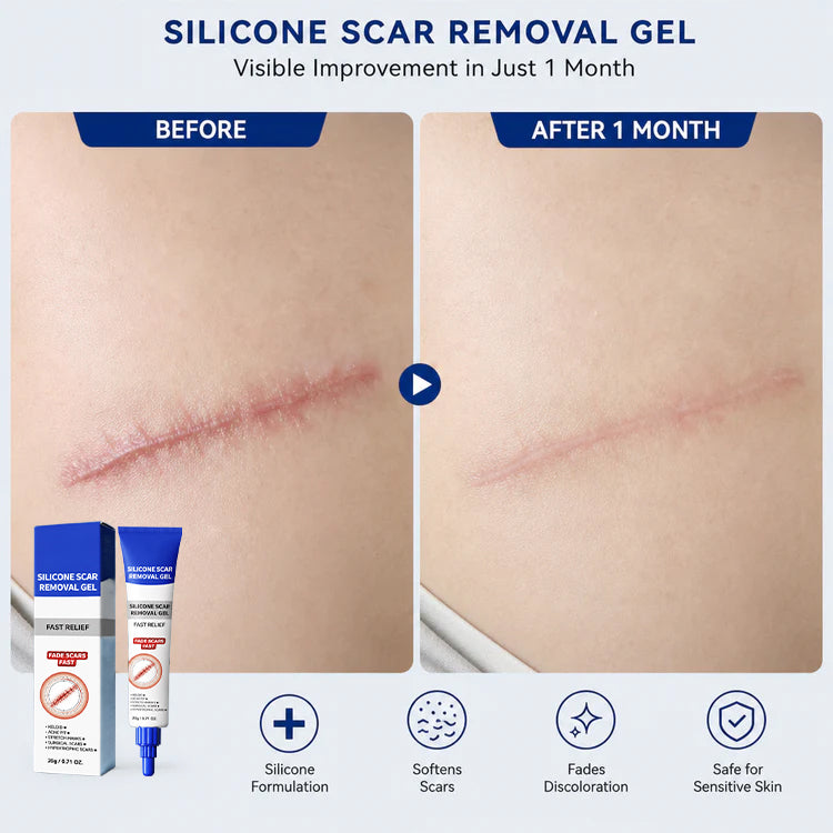 🔥 Advanced Silicone Scar & Wrinkle Smoothing Gel